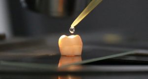 Учёные научились восстанавливать зубную эмаль без пломбирования